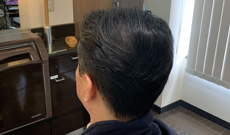 施術モデルアフター 左後ろ