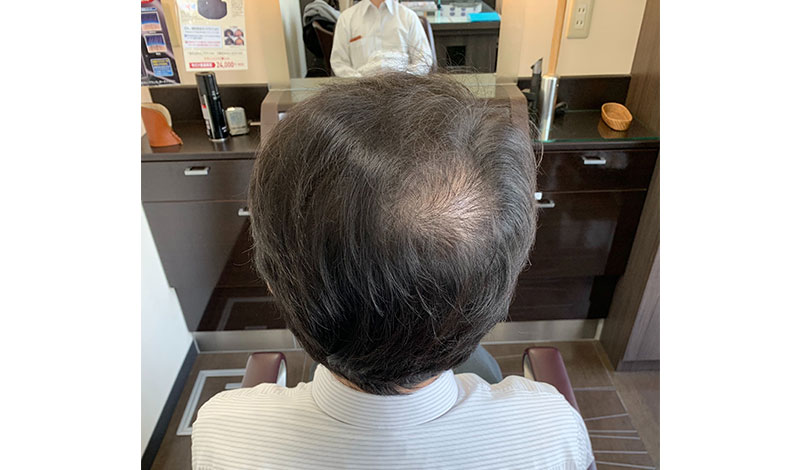 施術モデル 真後ろ